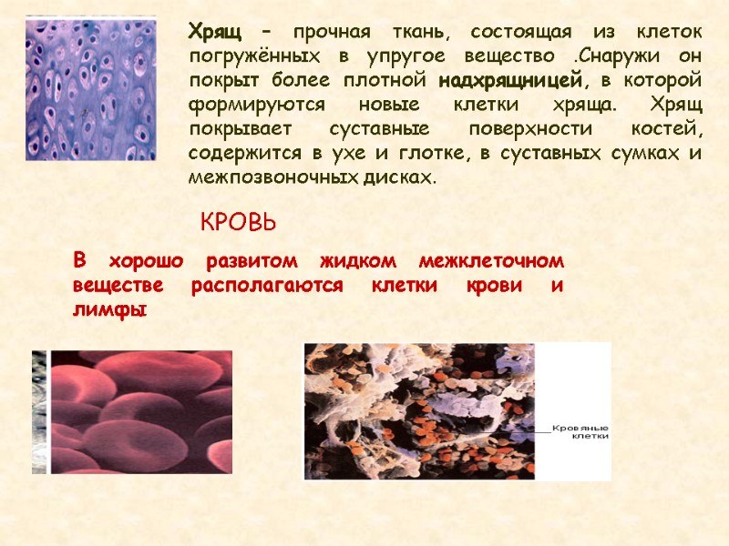 Хрящ – прочная ткань, состоящая из клеток погружённых в упругое вещество .Снаружи он покрыт